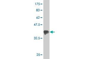 Western Blot detection against Immunogen (36. (ZFYVE16 Antikörper  (AA 1-100))