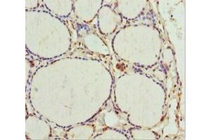 Immunohistochemistry of paraffin-embedded human thyroid tissue using ABIN7172703 at dilution of 1:100 (TAF9 Antikörper  (AA 1-264))