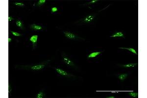 Immunofluorescence of purified MaxPab antibody to IFRD2 on HeLa cell. (IFRD2 Antikörper  (AA 1-442))