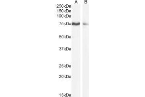 SLCO1B3 Antikörper  (Internal Region)