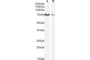 ABIN570800 (1µg/ml) staining of HEK293 (A) and A431 (B) cell lysate (35µg protein in RIPA buffer). (SLCO1B3 Antikörper  (Internal Region))