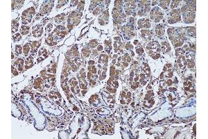 Immunohistochemistry of paraffin-embedded human stomach using SFRP1 antibody (ABIN1682675, ABIN1682676, ABIN5664178 and ABIN6219906) at dilution of 1:50 (20x lens). (SFRP1 Antikörper  (AA 30-314))