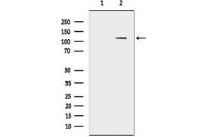 Western blot analysis of lysates from Mouse brain, using APP Antibody.