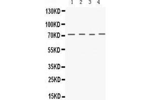 Western Blotting (WB) image for anti-Potassium Voltage-Gated Channel, Shaker-Related Subfamily, Member 4 (KCNA4) (AA 609-647), (C-Term) antibody (ABIN3043264) (Kv1.4 Antikörper  (C-Term))