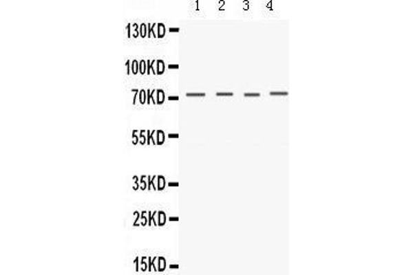 Kv1.4 anticorps  (C-Term)