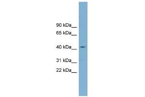 WB Suggested Anti-ZDHHC18 Antibody Titration:  0. (ZDHHC18 Antikörper  (Middle Region))