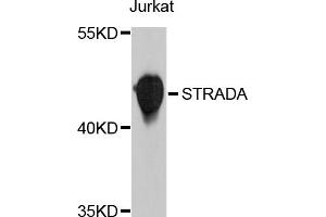 Western blot analysis of extracts of Jurkat cells, using STRADA antibody (ABIN4905332) at 1:1000 dilution. (STRADA Antikörper)