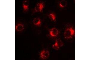 Immunofluorescent analysis of PiT2 staining in Hela cells. (SLC20A2 Antikörper)