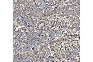 IHC analysis of Poliovirus Receptor/PVR using anti-Poliovirus Receptor/PVR antibody (ABIN7601069). (Poliovirus Receptor Antikörper  (AA 28-331))