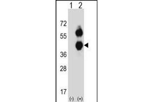 Western blot analysis of BCAT2 (arrow) using rabbit polyclonal BCAT2 Antibody (C-term) (ABIN656822 and ABIN2846033). (BCAT2 Antikörper  (C-Term))