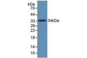 Western blot analysis of recombinant Human C5a. (C5A Antikörper  (AA 678-751))