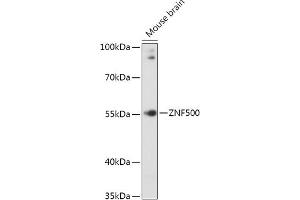 Western blot analysis of extracts of Mouse brain, using ZNF500 antibody (ABIN7271493) at 1:1000 dilution. (ZNF500 Antikörper  (AA 1-300))