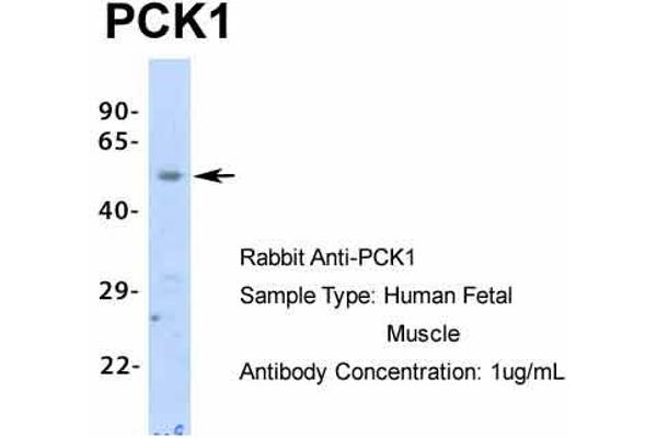 PCK1 Antikörper  (Middle Region)