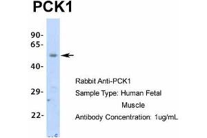 Host:  Rabbit  Target Name:  PCK1  Sample Type:  Human Fetal Muscle  Antibody Dilution:  1.