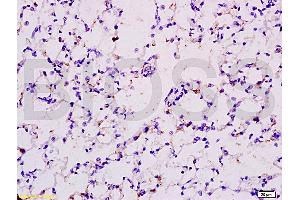 Formalin-fixed and paraffin embedded rat lung tissue labeled with Anti-EPOR Polyclonal Antibody (ABIN686347), Unconjugated at 1:200 followed by conjugation to the secondary antibody and DAB staining (EPOR Antikörper  (AA 301-450))