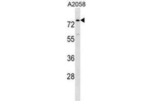 BCAS1 Antibody (N-term) western blot analysis in A2058 cell line lysates (35µg/lane). (BCAS1 Antikörper  (N-Term))