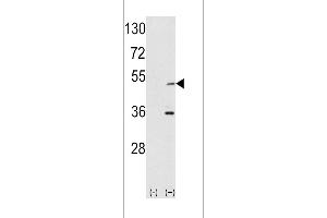 Western blot analysis of AIK using rabbit polyclonal hAIK-H105 using 293 cell lysates (2 ug/lane) either nontransfected (Lane 1) or transiently transfected with the AIK gene (Lane 2). (Aurora A Antikörper  (N-Term))