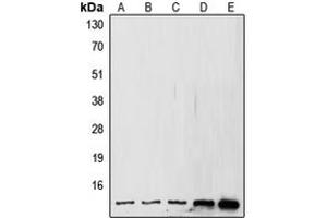 Western blot analysis of SUMO1 expression in MCF7 (A), A431 (B), HeLa (C), mouse kidney (D), rat kidney (E) whole cell lysates. (SUMO1 Antikörper  (N-Term))