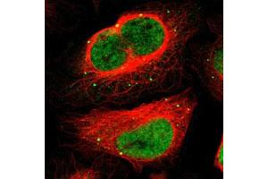 Immunofluorescent staining of U-2 OS with MEF2D polyclonal antibody  (Green) shows positivity in vesicles and nucleus but excluded from the nucleoli. (MEF2D Antikörper)
