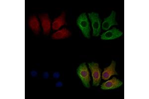 ABIN7094667 and ABIN7098718 staining Hela cells by IF/ICC. (Chromosome 6 Open Reading Frame 134 (C6orf134) (Internal Region) Antikörper)