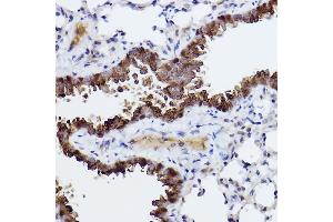 Immunohistochemistry of paraffin-embedded mouse lung using Caspase-6 Rabbit mAb (ABIN7266119) at dilution of 1:100 (40x lens). (Caspase 6 Antikörper)