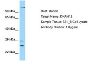 Image no. 1 for anti-Dynein, Axonemal, Heavy Chain 12 (DNAH12) (AA 91-140) antibody (ABIN6750179) (DNAH12 Antikörper  (AA 91-140))