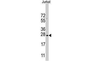 Western blot analysis of CLDN1 polyclonal antibody  in Jurkat cell lysate (35 ug/lane).