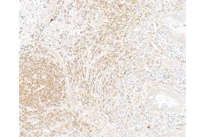 Immunohistochemistry (IHC) image for anti-Nuclear Factor of kappa Light Polypeptide Gene Enhancer in B-Cells 1 (NFKB1) (C-Term) antibody (ABIN7795778)