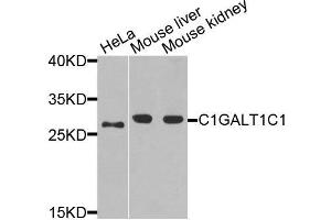 Western blot analysis of extracts of various cells, using C1GALT1C1 antibody. (C1GALT1C1 Antikörper)