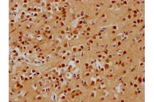 IHC image of ABIN7143183 diluted at 1:200 and staining in paraffin-embedded human brain tissue performed on a Leica BondTM system. (ADNP Antikörper  (AA 867-1102))