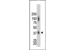 The anti-CKM Pab is used in Western blot to detect CKM in mouse heart tissue lysate. (CKM Antikörper  (N-Term))