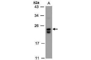 WB Image Sample(30 ug whole cell lysate) A:Raji , 12% SDS PAGE antibody diluted at 1:500 (DUSP19 Antikörper)