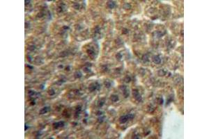 Used in DAB staining on fromalin fixed paraffin-embedded Liver tissue (Lacritin Antikörper  (AA 20-138))