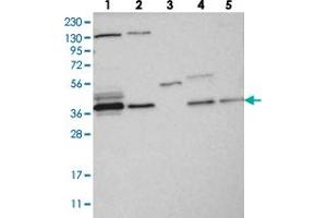 Western blot analysis of Lane 1: RT-4, Lane 2: U-251 MG, Lane 3: Human Plasma, Lane 4: Liver, Lane 5: Tonsil with VTA1 polyclonal antibody  at 1:250-1:500 dilution. (VTA1 Antikörper)