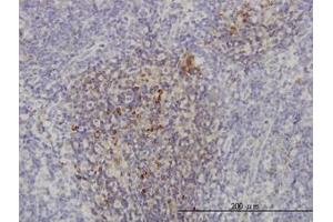 Image no. 1 for anti-Phosphoinositide-3-Kinase, Catalytic, beta Polypeptide (PIK3CB) (AA 147-257) antibody (ABIN466076) (PIK3CB Antikörper  (AA 147-257))
