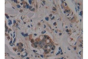 Immunohistochemistry (IHC) image for anti-Proteasome (Prosome, Macropain) 26S Subunit, Non-ATPase, 9 (PSMD9) (AA 2-223) antibody (ABIN7442213)