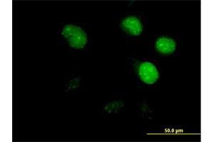 Immunofluorescence of purified MaxPab antibody to CDCA8 on HeLa cell. (CDCA8 Antikörper  (AA 1-280))
