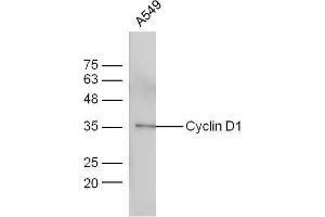 A549 cells probed with Anti-Cyclin D1 Polyclonal Antibody  at 1:5000 90min in 37˚C. (Cyclin D1 Antikörper  (AA 61-110))