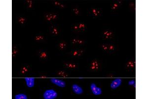 Confocal immunofluorescence analysis of U2OS cells using EBNA1BP2 Polyclonal Antibody at dilution of 1:200.