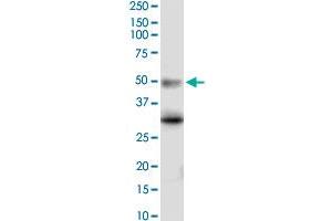 HTR5A monoclonal antibody (M02), clone 3D1. (Serotonin Receptor 5A Antikörper  (AA 223-282))