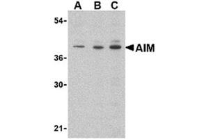 Image no. 1 for anti-CD5 Molecule-Like (CD5L) (C-Term) antibody (ABIN318735) (CD5L Antikörper  (C-Term))