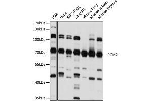 Western blot analysis of extracts of various cell lines, using PGM2 antibody (ABIN7269312) at 1:1000 dilution. (Phosphoglucomutase 2 Antikörper  (AA 1-130))