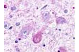 Anti-TAAR5 antibody IHC of human brain, thalamus, neurons and glia. (TAAR5 Antikörper  (Cytoplasmic Domain))