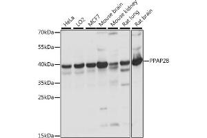 Western blot analysis of extracts of various cell lines, using PPB antibody (ABIN7269278) at 1:1000 dilution. (PPAP2B Antikörper  (AA 1-100))