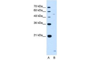 ST3GAL5 antibody used at 1.