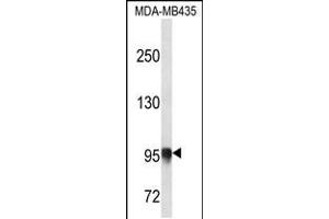 Western blot analysis in MDA-MB435 cell line lysates (35ug/lane). (PLOD3 Antikörper  (N-Term))