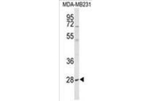 Western blot analysis of YIPF5 Antibody (N-term) in MDA-MB231 cell line lysates (35 µg/lane).