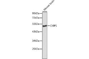 Western blot analysis of extracts of mouse brain, using CtBP1 Antibody (ABIN3022421, ABIN3022422, ABIN3022423, ABIN1512783 and ABIN6218809) at 1:1000 dilution. (CTBP1 Antikörper  (AA 20-250))