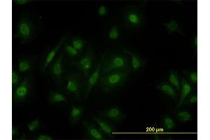 Immunofluorescence of monoclonal antibody to PCQAP on HeLa cell. (MED15 Antikörper  (AA 1-88))