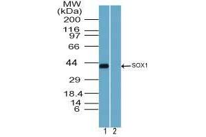 Image no. 3 for anti-SRY (Sex Determining Region Y)-Box 1 (SOX1) (AA 100-150) antibody (ABIN960348) (SOX1 Antikörper  (AA 100-150))